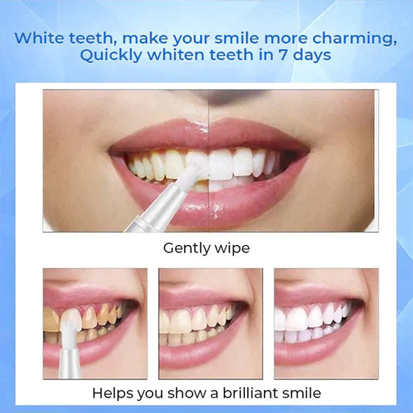 Instant Teeth Whitening Pen - Dazzling