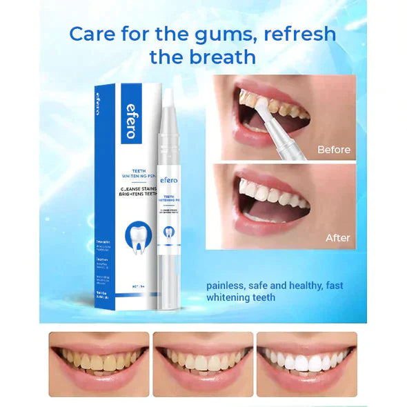 Instant Teeth Whitening Pen - Dazzling